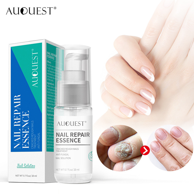 AuQuest ยาทาเล็บ บํารุงเล็บ Nail Repair Serum ยาทาเล็บขบ เล็บขบ ซ่อม