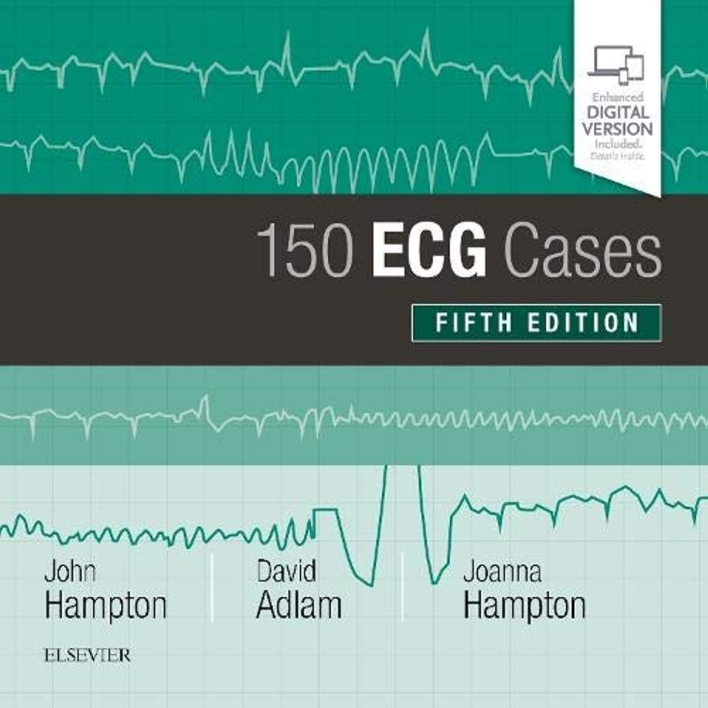 [หนังสือ] 150 ECG Cases คลื่นไฟฟ้าหัวใจ the made easy practical ekg ...