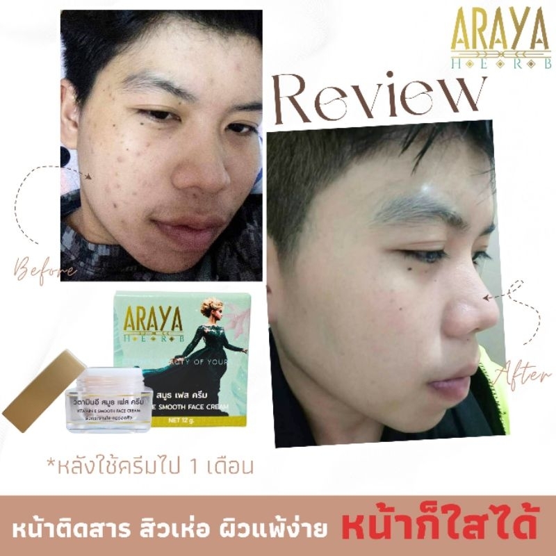 ส่งฟรี-ครีมหน้าเนียนครบเซตบำรุงกลางคืน-amp-กลางวันและกันแดด-ครีมลดสิว-ฝ้า-หน้าหมองคล้ำ-ทำให้ผิวหน้ากระจ่างใส