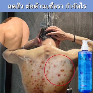 เจลอาบน้ํา ครีมอาบน้ำลดสิว เจลอาบน้ำไวท์เทนนิ่งผิว 260ml อ่อนโยนไม่ระคายเคือง กำจัดไร ล้างให้มีผิวสวยใสไร้สิวออ