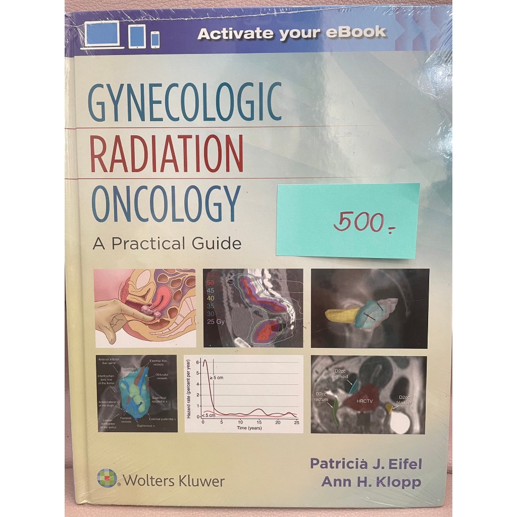 Gynecologic Radiation Oncology: A Practical Guide 1st Edition | Shopee ...