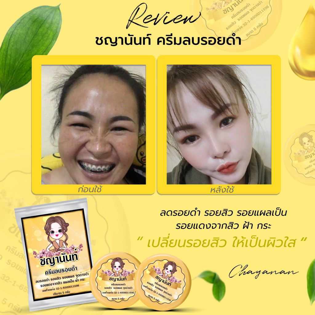 ครีมลบแผลเป็น-ลดรอยแผลเป็น-แผลผ่าตัด-แผลไฟไหม้-น้ำร้อนลวก-ซ่อมแซมผิวที่เสียให้ใหม่-เร่งการซ่อมแซมให้ผิว