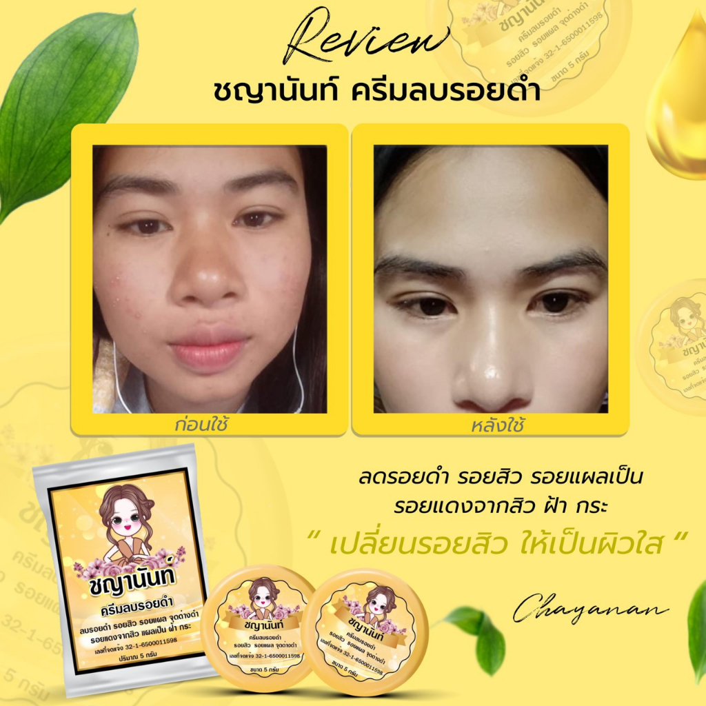 ครีมลบแผลเป็น-ลดรอยแผลเป็น-แผลผ่าตัด-แผลไฟไหม้-น้ำร้อนลวก-ซ่อมแซมผิวที่เสียให้ใหม่-เร่งการซ่อมแซมให้ผิว