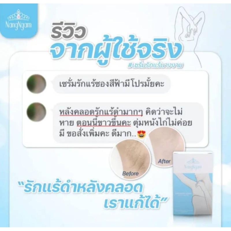 2-กล่อง-โฉมใหม่-มีฝาเกลียว-เซรั่มรักแร้นางงาม-ราคาพิเศษทักด่วนๆ