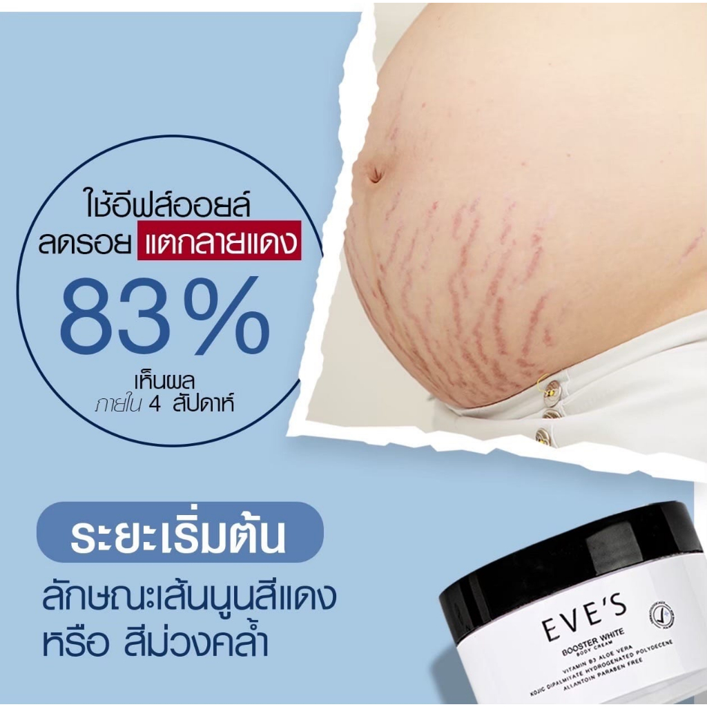 eves-บูสเตอร์อีฟส์-ครีมลดรอยแตกลาย-ผิวชุ่มชื้น-ผิวขาวกระจ่างใส-เนียนนุ่ม-ลดรอยแผลเป็นจุดด่างดำ