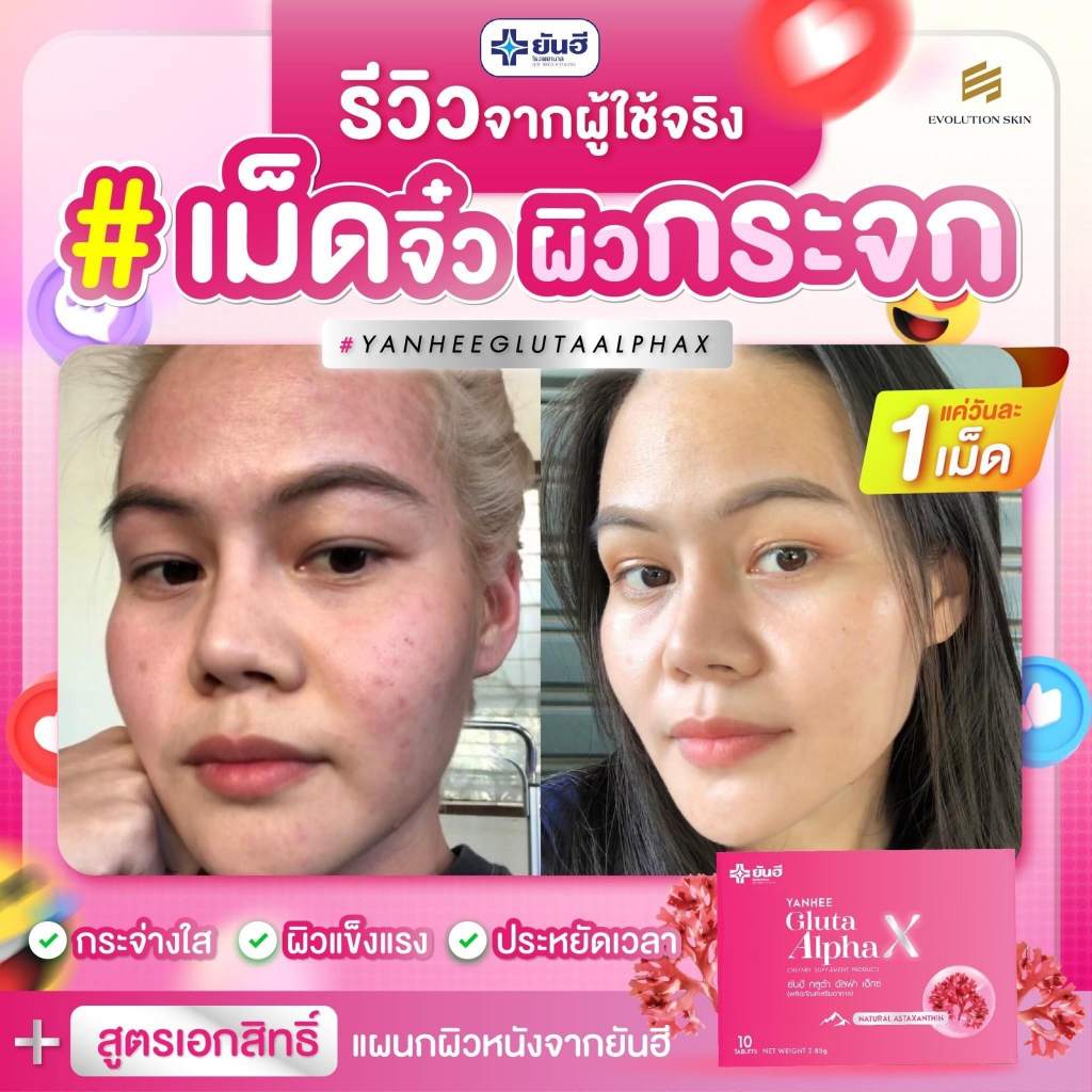 yanhee-gluta-alpha-x-ยันฮี-กลูต้า-อัลฟ่า-เอ็กซ์-อาหารเสริมดูแลผิวยันฮี-1-กล่อง