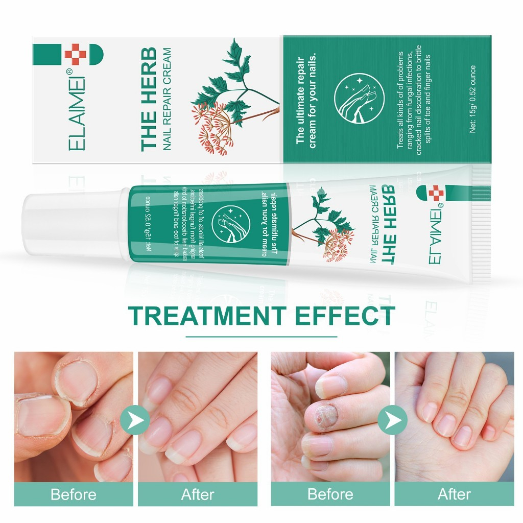 THE HERB NAIL REPAIR CREAM 15g.ทรีทเม้นท์สมุนไพรฟื้นฟูซ่อมแซมทุกปัญหา