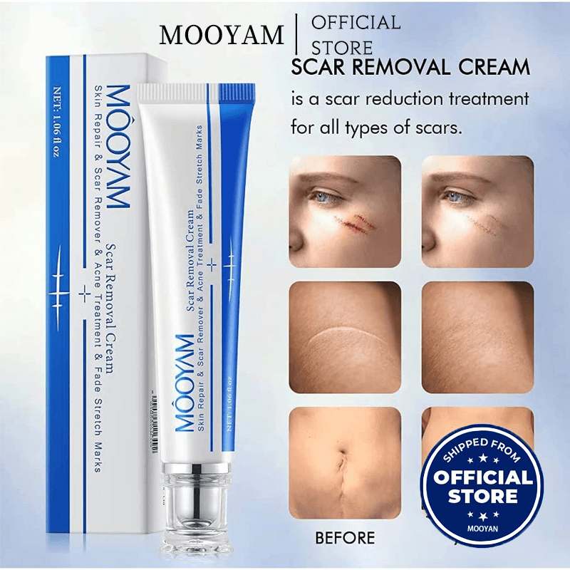 MOOYAM Scar removing cream 30g Keloid scars/ core scars/ dark scars ...