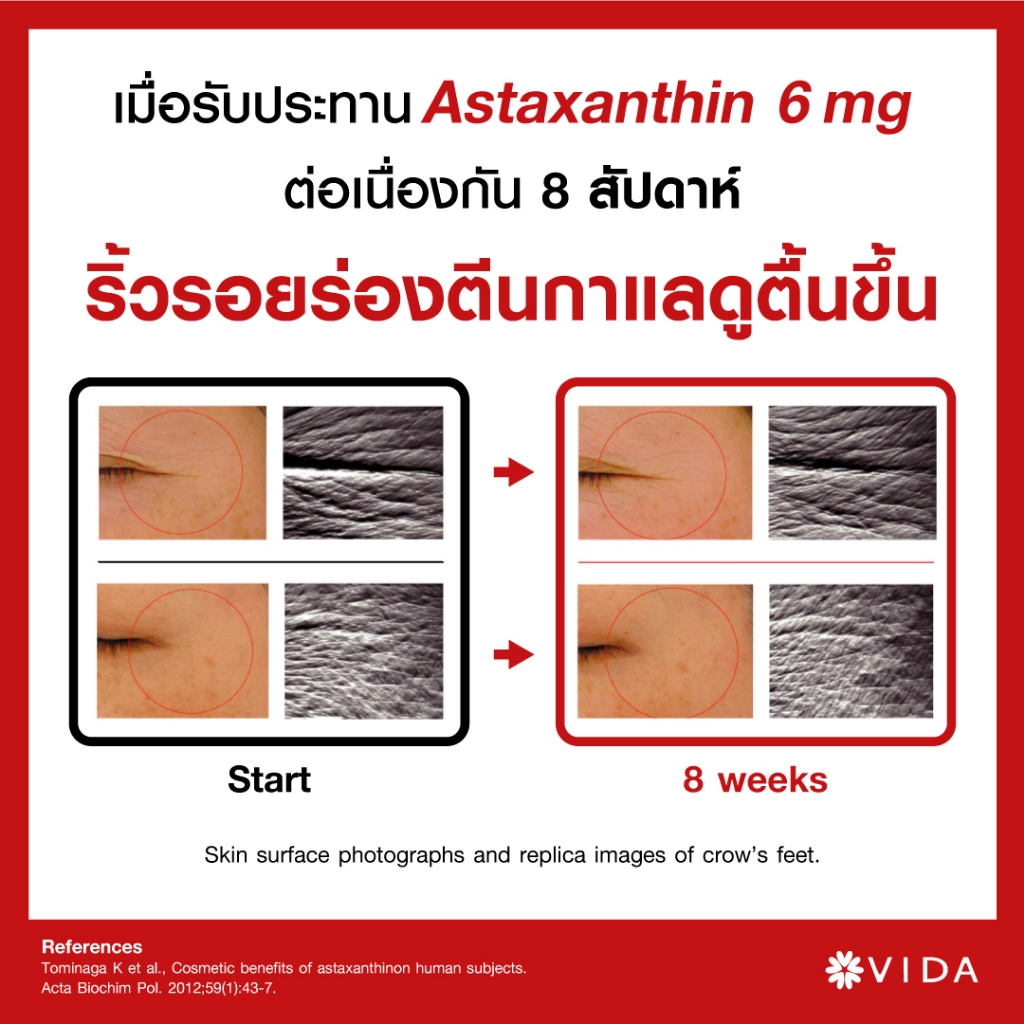 Vida Astaxanthin 6 mg Q10 AstaReal (วีด้า แอสต้าแซนธิน คิวเท็น 30 แคปซูล) สาหร่ายแดง แอสตาแซนธิน สาหร่ายฮีมาโตค็อกคัส Haematococcus