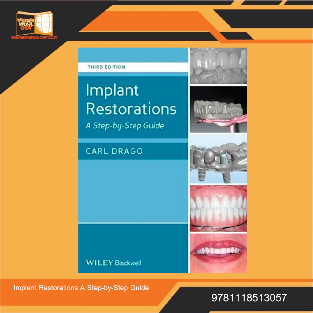 Implant Restorations: A Step-by-Step Guide 3rd Edition | Shopee Thailand