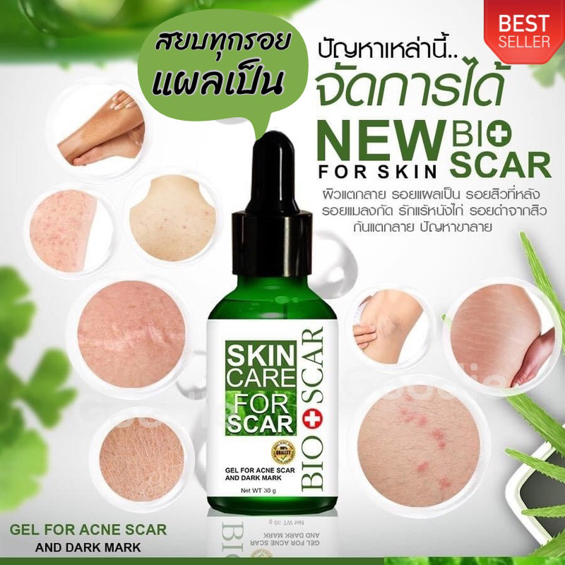Bio Scar ไบโอสการ์ เซรั่มลดรอยแผลเป็น รอยดำ ตุ่ม รอยสิว แผลเป็น ...