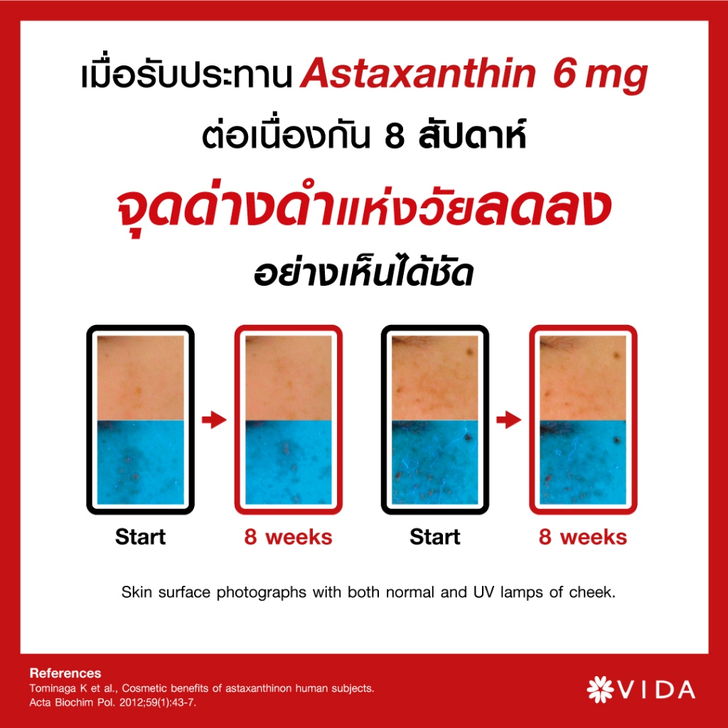 Vida Astaxanthin 6 mg Q10 AstaReal (วีด้า แอสต้าแซนธิน คิวเท็น 30 แคปซูล) สาหร่ายแดง แอสตาแซนธิน สาหร่ายฮีมาโตค็อกคัส Haematococcus