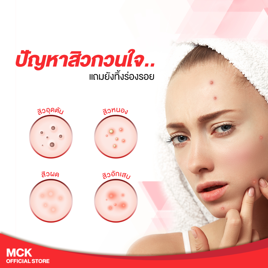 x-pert-acne-hydrogel-ผลิตภัณฑ์ดูแลผิวหน้า-เจลแต้มสิว-สิวอุดตัน-สิวอักเสบ-ผิวอักเสบ-รอยสิว-10-g