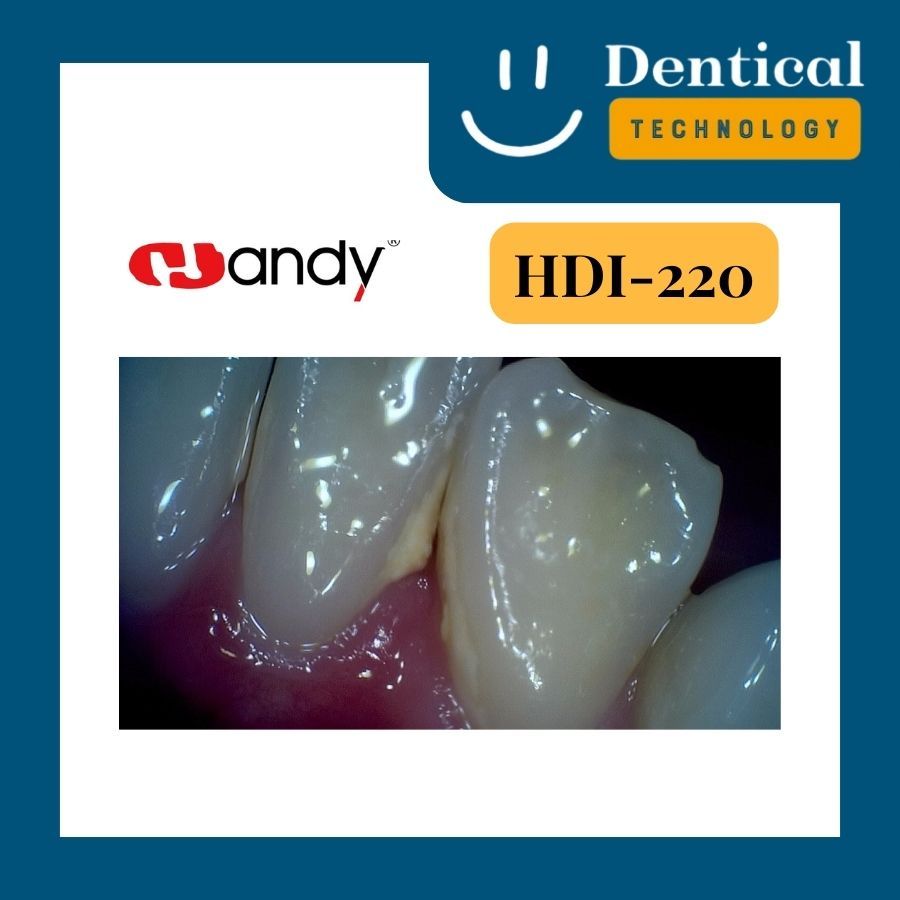 เครื่องศูนย์ไทย-กล่องถ่ายภาพในช่องปาก-handy-hdi-220-intraoral-camera-hdi-220