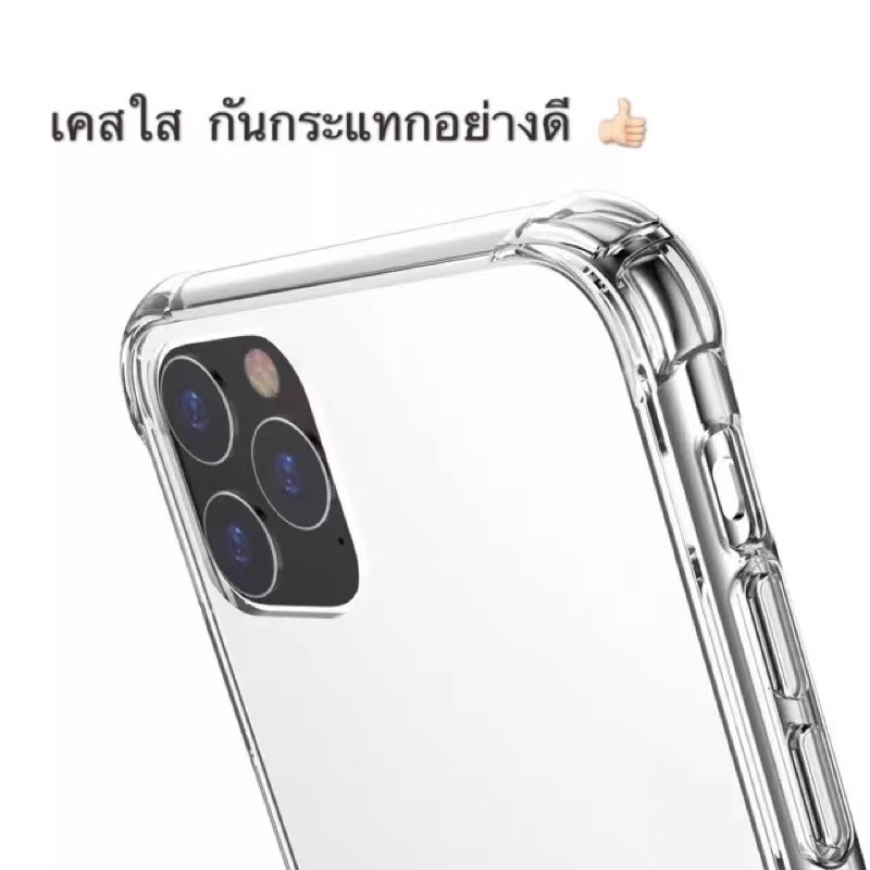 เคสใส-คิงคอง-samsung-a05-a05s-a12-a02-m12-m02-a11-m11-a22-a32-a02s-a72-a73เคส-ซัมซุงcase-เคสกันกระแทก-เคสโทรศัพท์