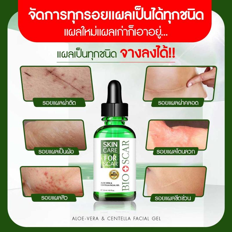 Bio scar ไบโอสการ์ ลดรอยแผลเป็น ลดผิวแตกลาย ลบรอยแผลเป็น ท้องลาย แผลนูน ...