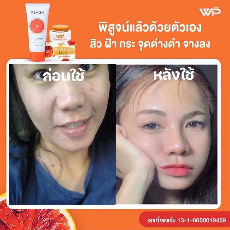 blood-orange-cream-ครีมส้มสีเลือดwp-ลดฝ้า-กระ-สิว-ริ้วรอยหาย