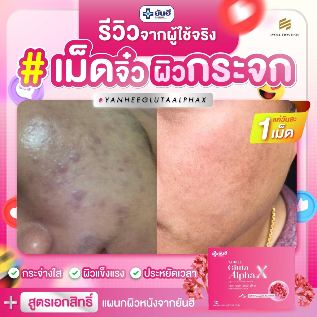 yanhee-gluta-alpha-x-ยันฮี-กลูต้า-อัลฟ่า-เอ็กซ์-อาหารเสริมดูแลผิวยันฮี-3-กล่อง