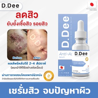 [เซรั่มลดสิว] D.Dee เซรั่มคุณหมอ รีวิวแน่นมาก ลดสิวทุกชนิด ลดรอยสิว ป้องกันการเกิดสิวใหม่ ผ่านการทดสอบโดยแพทย์ผิวหนัง