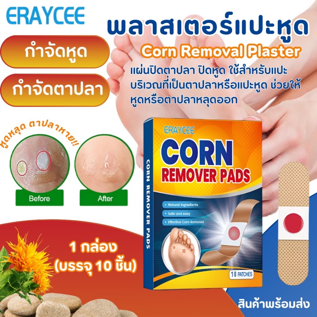 Foot Corn Removal Patches Plaster Warts Thorn Remover Patch Pads ...