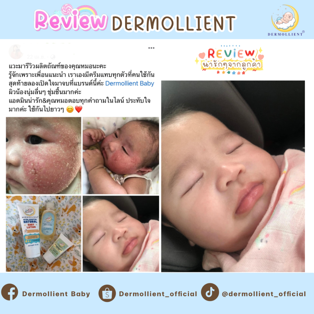 บาล์มสำหรับเด็กผิวแพ้ง่าย-25-กรัม-โดยแพทย์ผิวหนังเด็ก-dermollient-baby-balm-plus