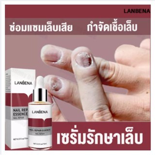 LANBENA เซรั่มเล็บ บำรุงเล็บ เล็บขบ เชื้อรา ซ่อมแซมเล็บแตก เล็บเปราะ เล็บหนา 15ml. (แถมฟรี!! ตะไบเล็บ)