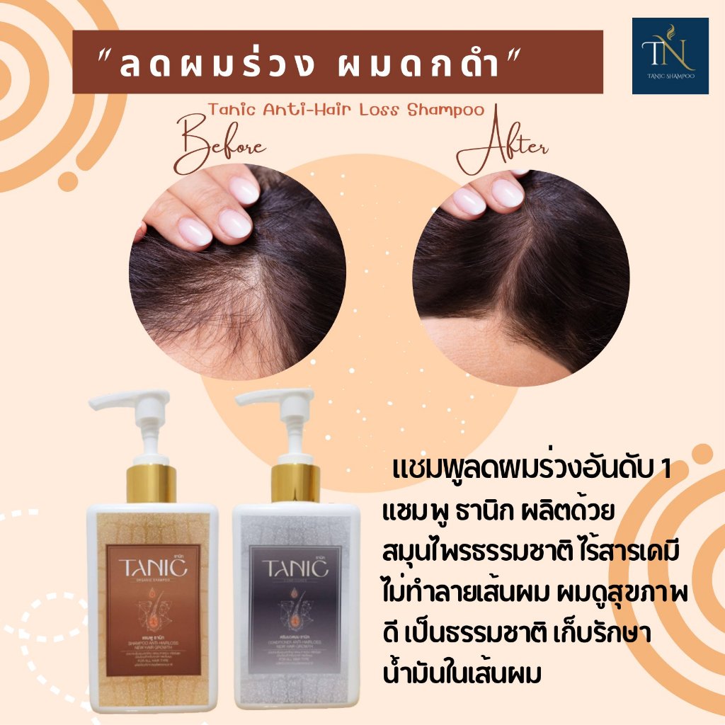 [ของแท้] Tanic ธานิก แชมพูลดผมร่วง ผมเกิดใหม่ แก้รังแค สะเก็ดเงิน แก้ผม ...