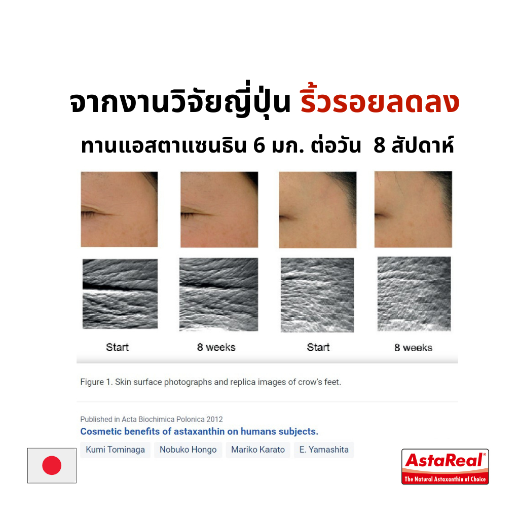 MATELL AstaReal Astaxanthin 6 mg from japan 30 softgels แอสตาแซนธิน จาก ญี่ปุ่น 6 มก 30 ซอฟต์เจล เพิ่มความชุ่มชื้น ลดเลือนริ้วรอย ด้วยสารสกัดจาก สาหร่ายสีแดง สาหร่ายฮีมาโตค็อกคัส พลูวิเอลิส Haematococcus