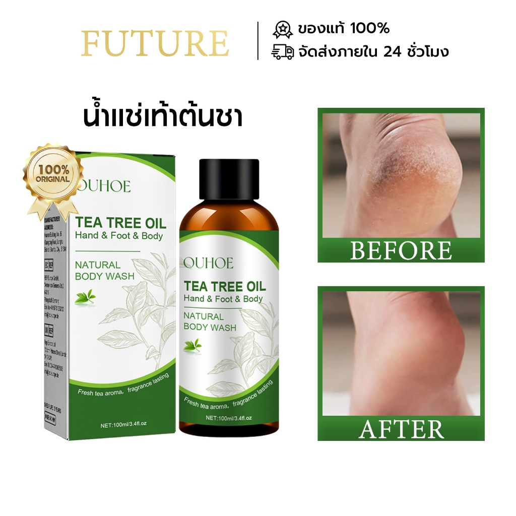 OUHOE Tea Tree Oil น้ำแช่เท้าต้นชา 100ML น้ำมันนวดเท้าต้นชา ฟื้นฟูส้น ...