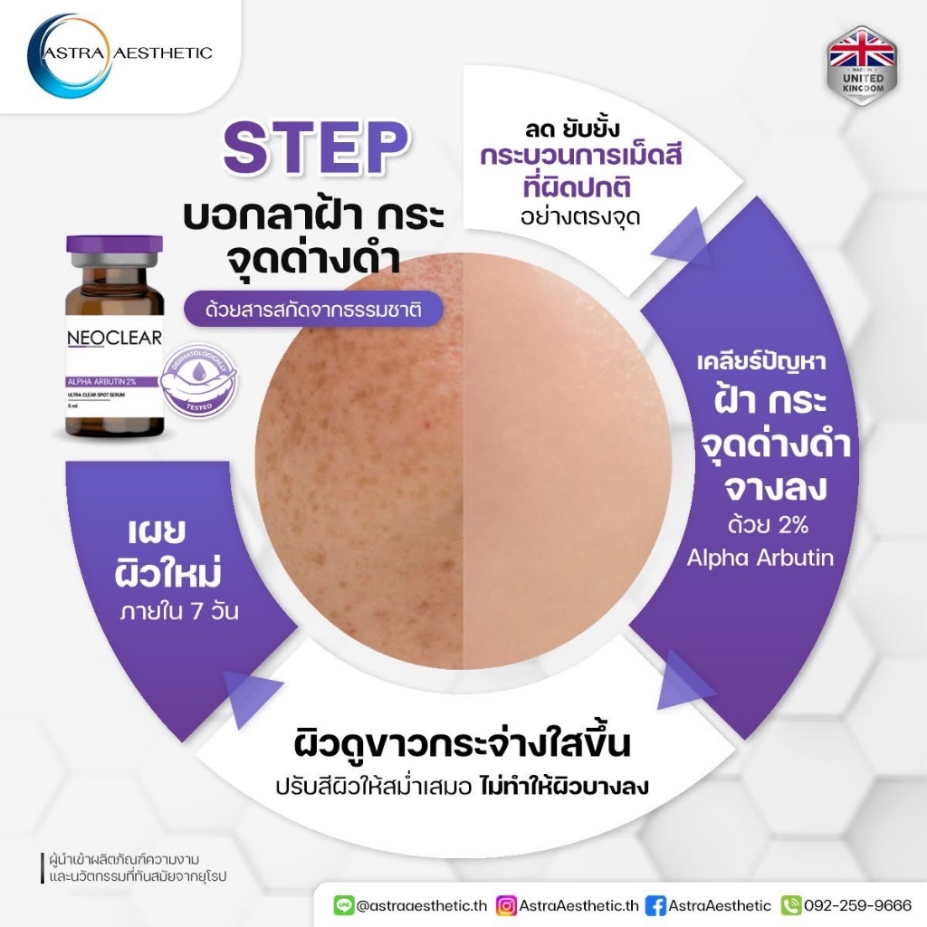 NEO CLEAR (ฝ้า กระ รอยดำ ไม่แสบ) 5ml/ขวด | Shopee Thailand
