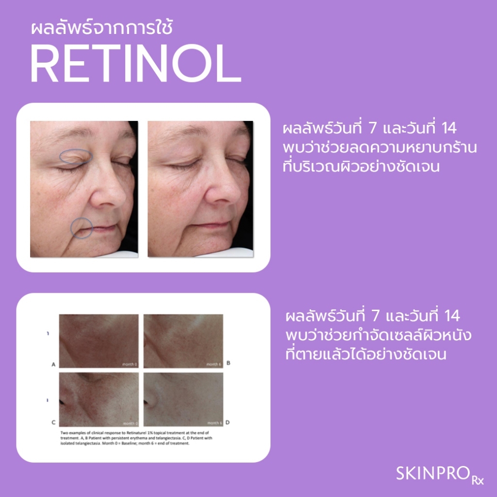 SKINPRO Rx Retinol Complex Serum เรตินอลเซรั่ม ช่วยลดเลือนริ้วรอย ปรับ ...