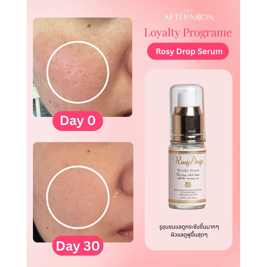 ロージードロップ リンクルセラム 20mL 【公式通販】