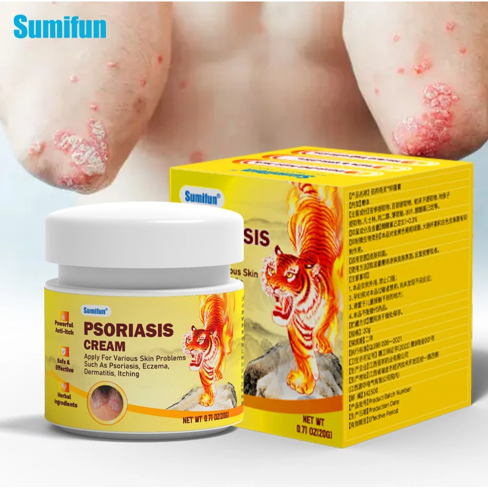 sumifun Psoriasis Cream Antifungal cream Eczema cream Cream แบ่งปัน ...