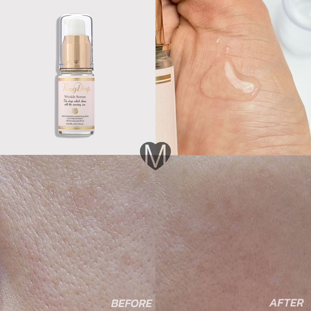 Rosy Drop Wrinkle Serum 20ml เซรั่ม บอลลูน กุหลาบ ไล่ริ้วรอย