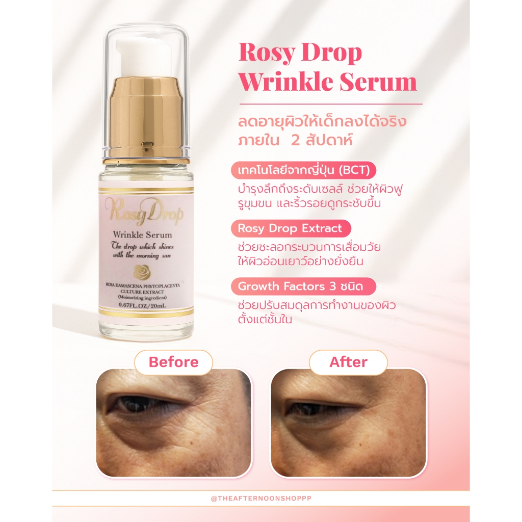 ロージードロップ リンクルセラム 20mL 【公式通販】