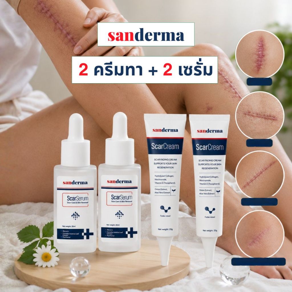 ชุดดูแลรอยแผลเป็น Sanderma (ครีม 2 กระปุก + เซรั่ม 2 ขวด) สำหรับแผลเป็น ...