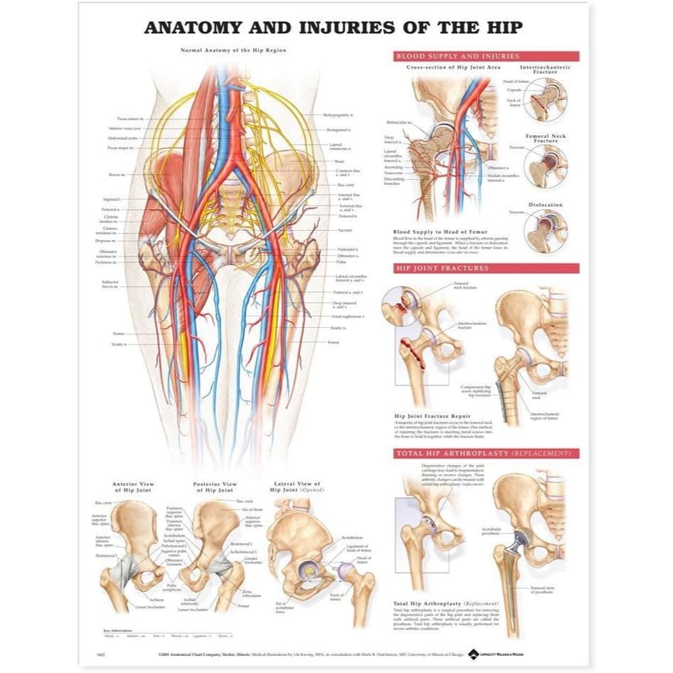 แผ่นโปสเตอร์ Anatomy and Injuries of the Hip Anatomical Chart (Paper ...