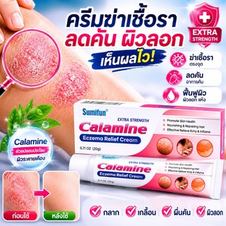 Kem diệt nấm giảm ngứa, da bong tróc, viêm da, nấm da, nấm chân; dùng được cho cả tay và chân.