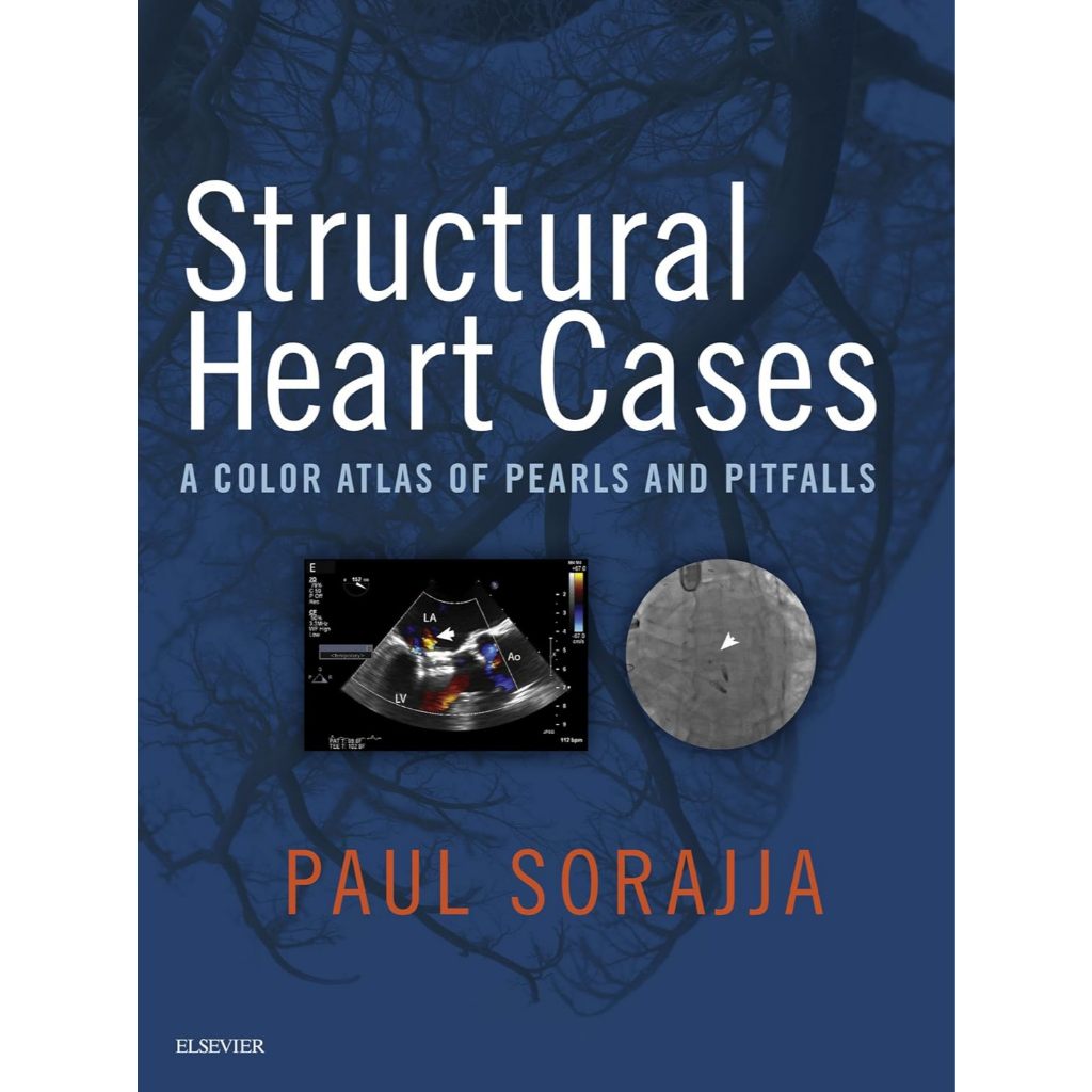 หนังสือ Structural Heart Cases: A Color Atlas of Pearls and Pitfalls ed ...