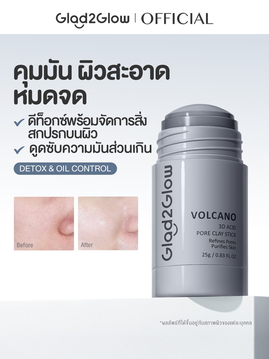 【PROXIE'S PICK】Glad2Glow Mugwort Salicylic Acid Acne Clay Stick มาร์คหน้า mask แผ่นมาร์คหน้า มาร์ค มาร์คหน้าลดสิว - 5