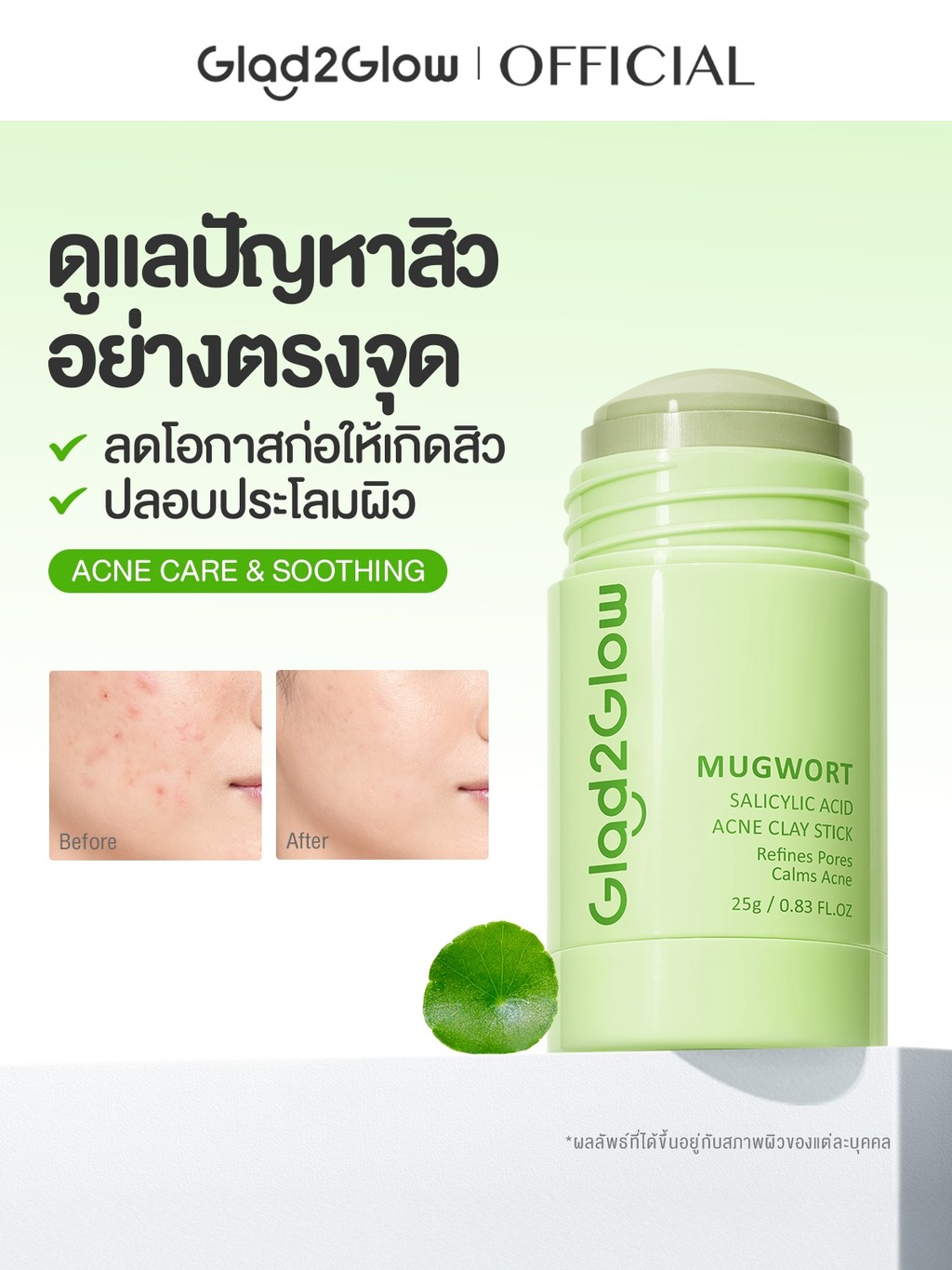 【PROXIE'S PICK】Glad2Glow Mugwort Salicylic Acid Acne Clay Stick มาร์คหน้า mask แผ่นมาร์คหน้า มาร์ค มาร์คหน้าลดสิว - 4