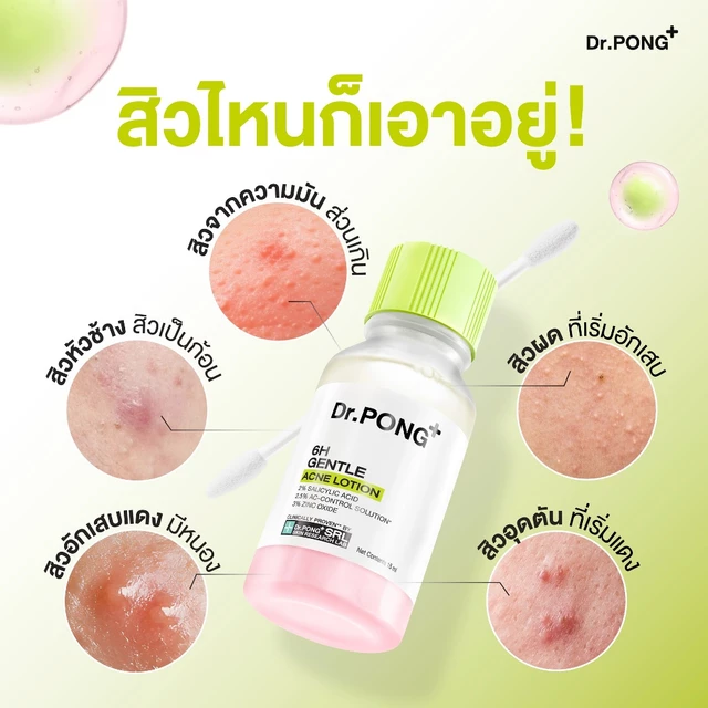 [3 ฟรี 1] Dr.PONG 6H GENTLE ACNE LOTION แป้งน้ำแต้มสิว สิวยุบใน 1 คืน แห้งไว ไม่ทิ้งรอย ไม่ขึ้บนซ้ำ