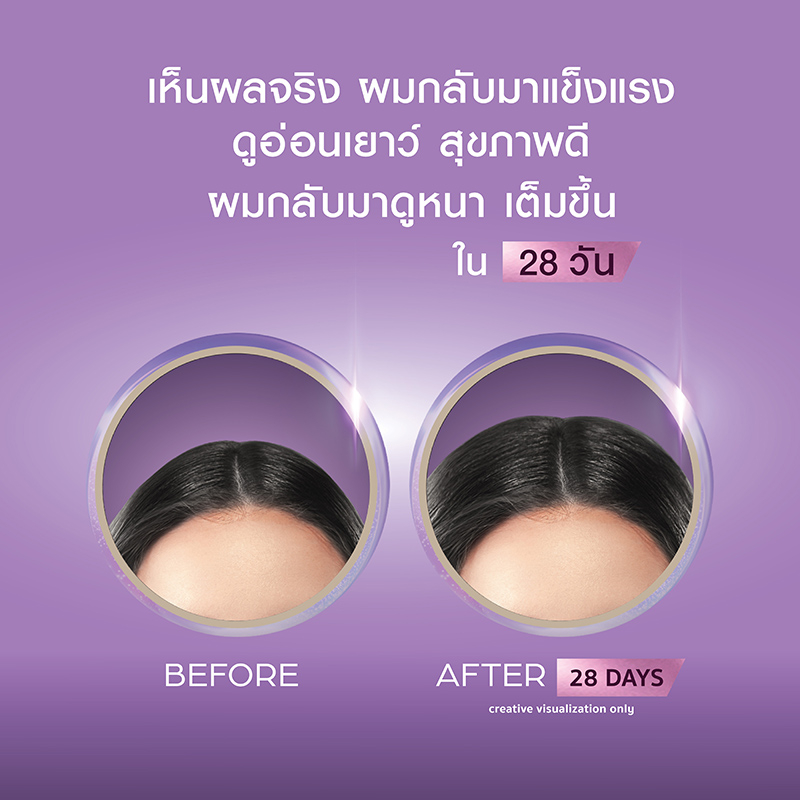 คำอธิบายเพิ่มเติมเกี่ยวกับ CLEAR แชมพูลดผมร่วง ลดผมบาง เพิ่มวอลลุ่ม (สูตรลดผมร่วง ผมบาง เห็นผลจริงใน 14 วัน) แชมพู 300 มล. และ ครีมนวด 300 มล.