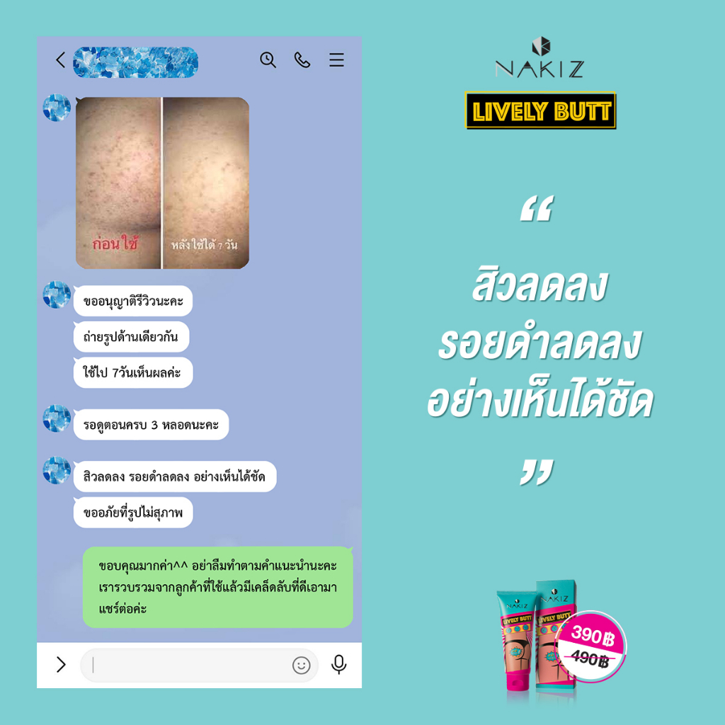 เกี่ยวกับ NAKIZ LIVELY BUTT - ครีมทา ก้นดำ รักแร้ดำ ขาหนีบดำ สิวหลัง หัวเข่าดำ ศอกดำ ลบเลือนรอยดำ แตกลาย คอดำ