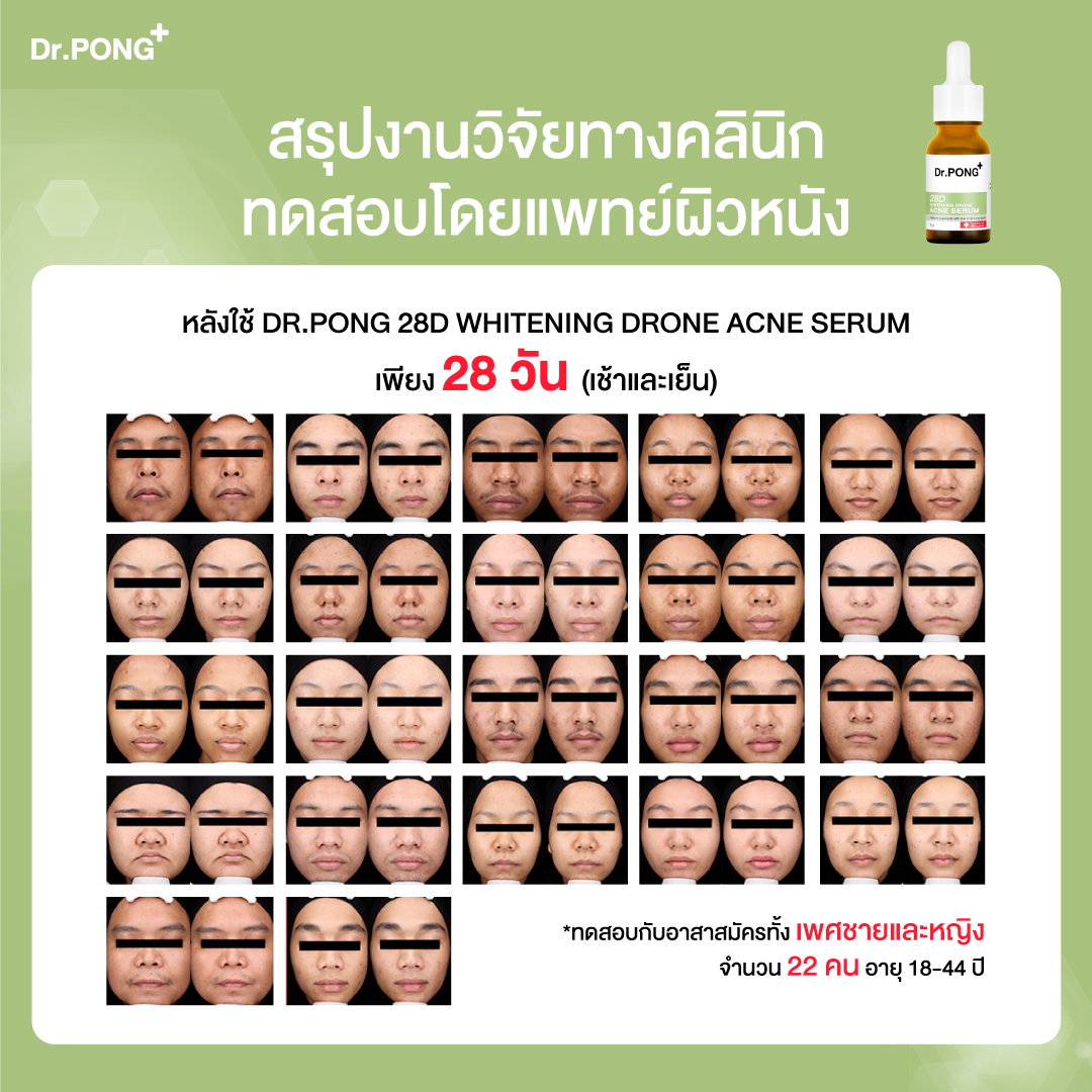 ภาพประกอบของ Dr.PONG 28d whitening drone acne serum เซรั่มสำหรับคนเป็นสิวพร้อมลดรอย 2%BHA ZincPCA Niacinamide