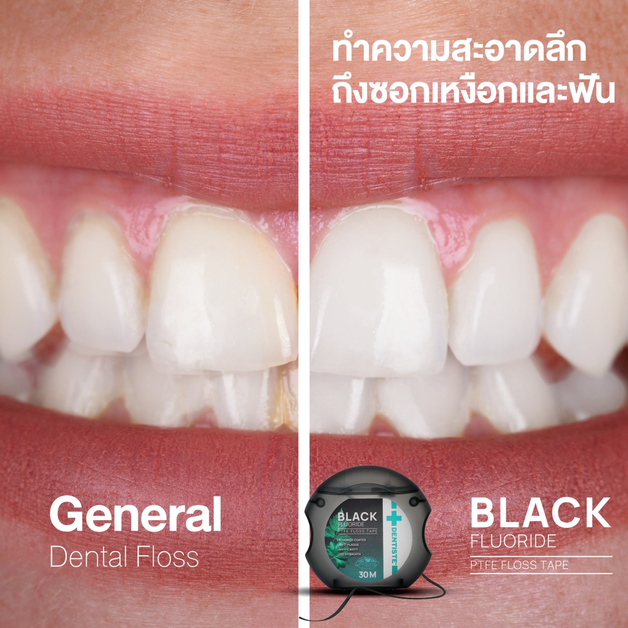 Dentiste' Dentiste Dental Black PTFE Floss Tape with Fluoride 30m ไหมขัดฟันเคลือบฟลูออไรด์ ขจัดคราบพลัค ป้องกันฟันผุ นุ่มพิเศษ ทำความสะอาดลึกถึงซอก