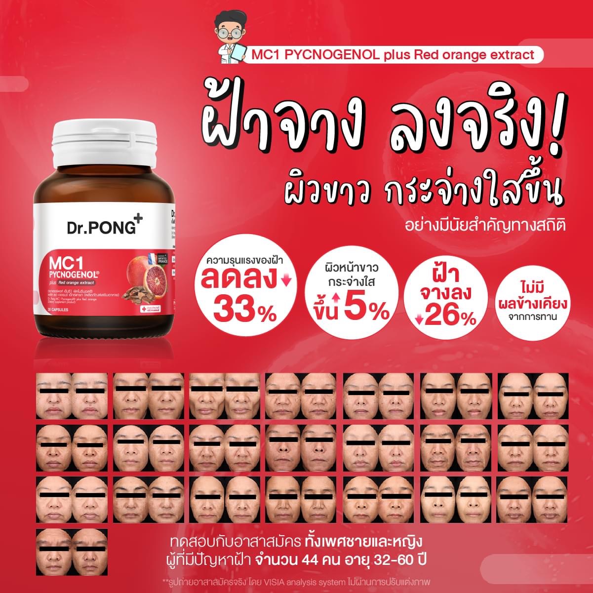 [ช้อปครบ รับฟรี] Dr.PONG MC1 PYCNOGENOL plus Red orange extract วิตามิน ...