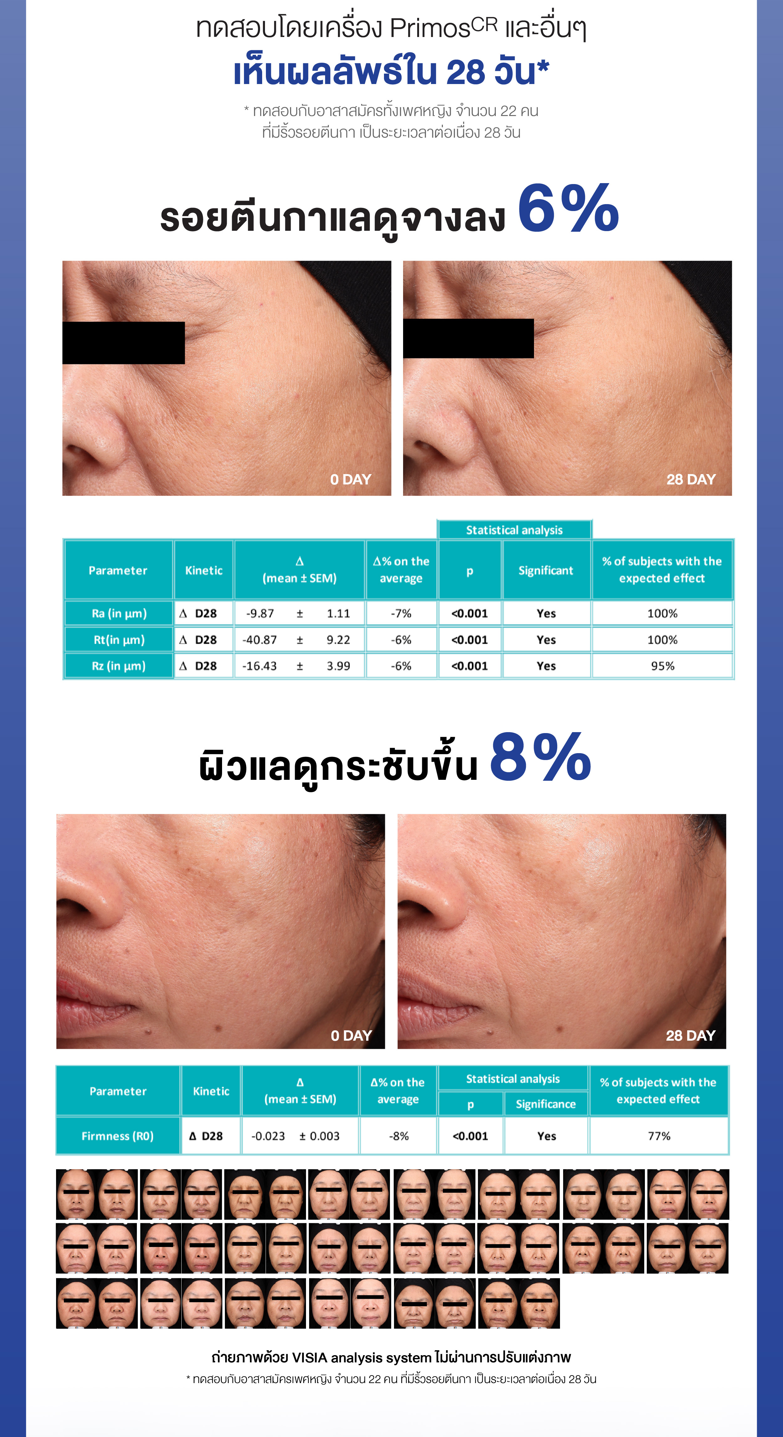 Dr.PONG RETINAL-X TIMELESS ANTI-AGING SERUM เซรั่มลดเลือนริ้วรอย ...