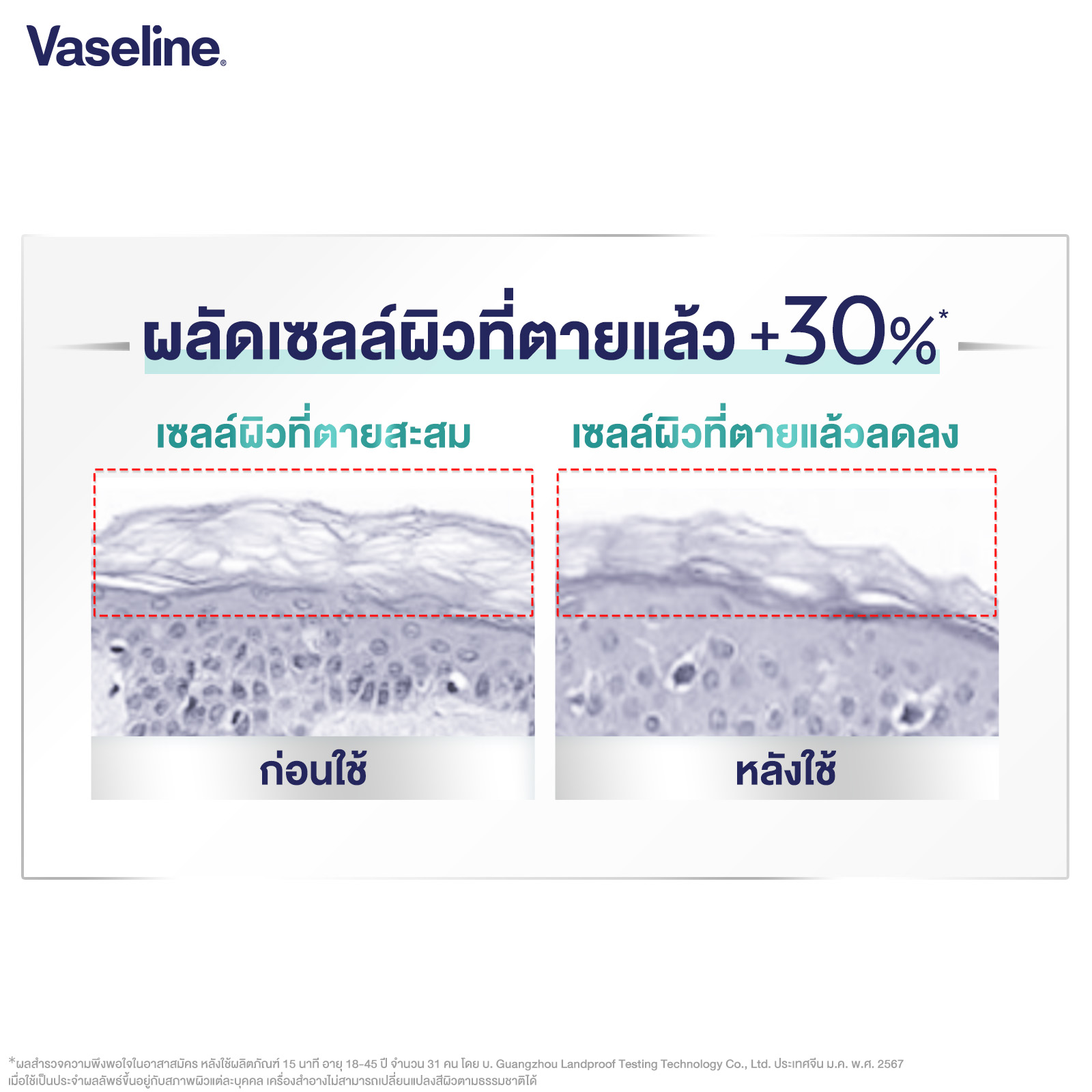 [อยู่ระหว่างเปลี่ยนบรรจุภัณฑ์] วาสลีน โปร เดอร์มา โลชั่น บอดี้แอมพูล ...