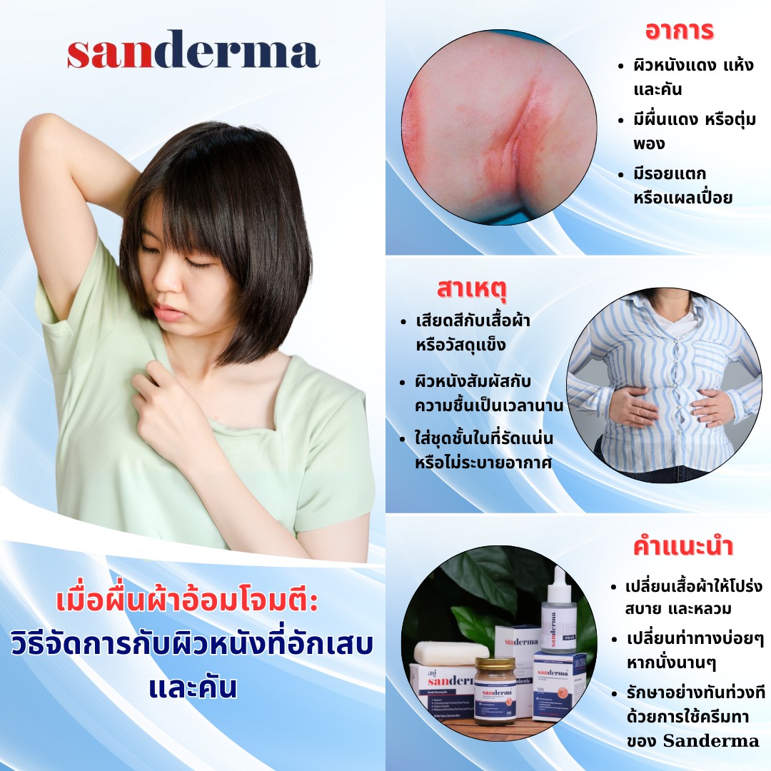 COMBO CREAM & SERUM SANDERMA เชี่ยวชาญเฉพาะด้าน โรคผิวหนังทุกชนิด โรค ...